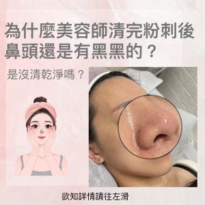 Read more about the article 【北投美容】Vi’s Beauty 是不是很多甜心們都有疑問
 為什麼做完臉，鼻頭看起來好像還是…