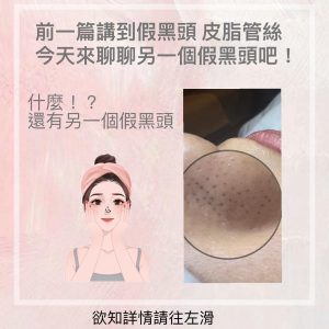 Read more about the article 【北投美容】Vi’s Beauty 什麼鼻子上的小黑點竟然不是黑頭粉刺！！！
 清了很久都清不完…