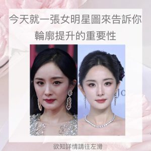 Read more about the article 【北投美容】Vi’s Beauty 輪廓提升到底重不重要呢？
 照片可以用美圖秀秀
 但是真實生…