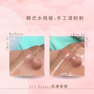 Read more about the article 【北投美容】Vi’s Beauty 請不要吝嗇毛孔清潔的錢 因為精華更貴