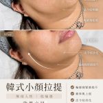 【北投美容】Vi’s Beauty 不是修圖，是輪廓真的上來了

韓式小顏拉提
無侵入性｜低痛感…